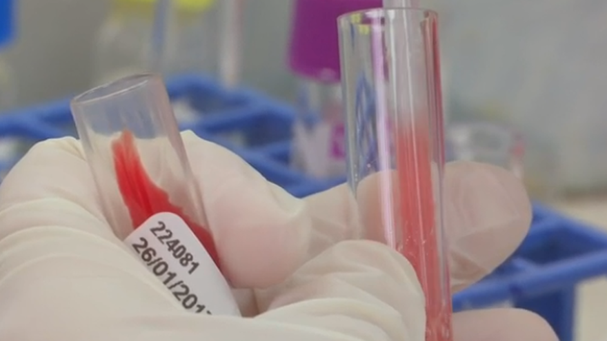 El estudio fue realizado a 1,005 pacientes