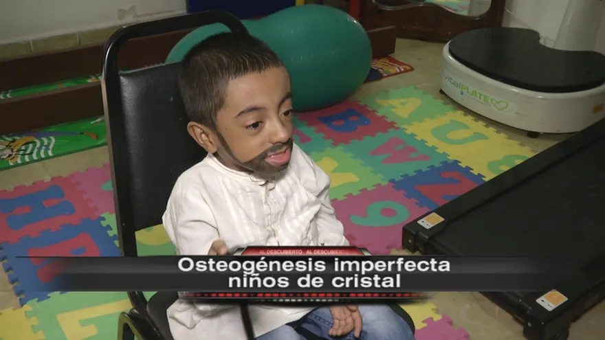 Osteogénesis imperfecta niños de cristal