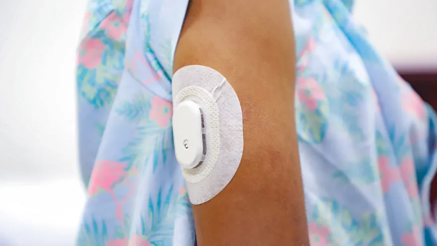La nueva tecnología de monitoreo continuo de glucosa para niños que padecen diabetes.