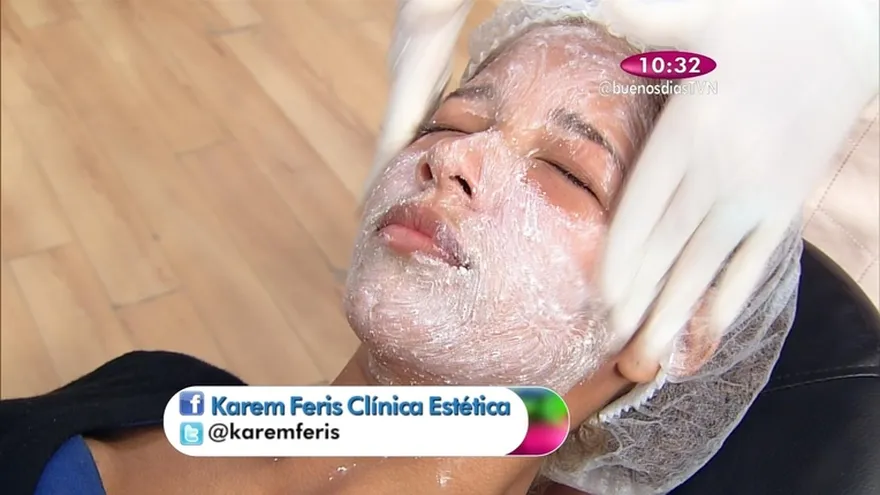 Segmento Estética "Tratamientos para arrugas y líneas de expresión"