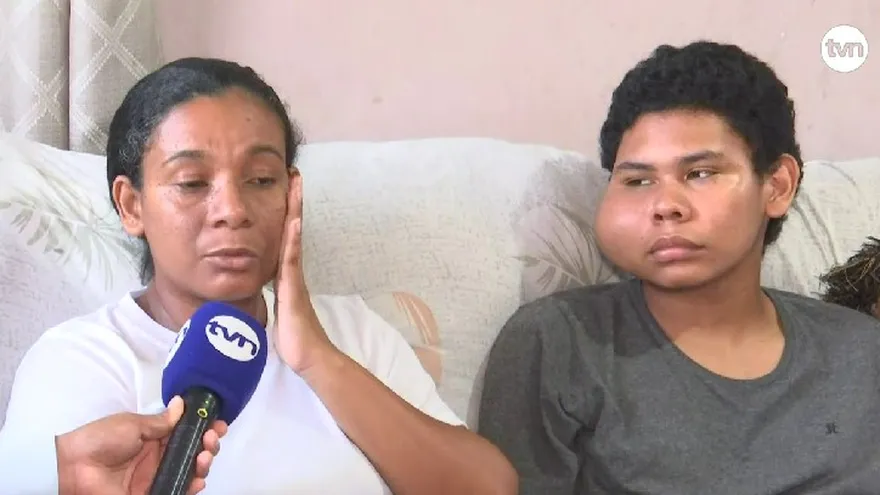 Adolescente en La Chorrera requiere deuna cirugía para extirparle un tumor en el rostro
