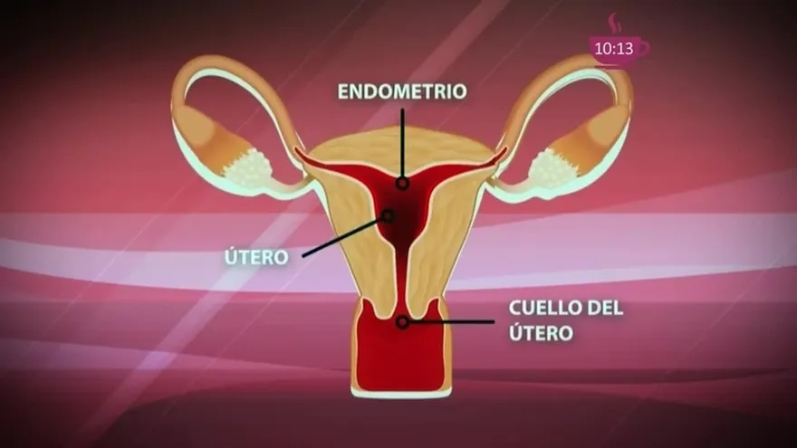 ¡Qué pesadilla! cuando llegan los cólicos menstruales.
