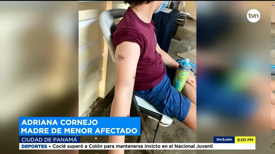Varios heridos por incidentes con monos en isla de Portobelo