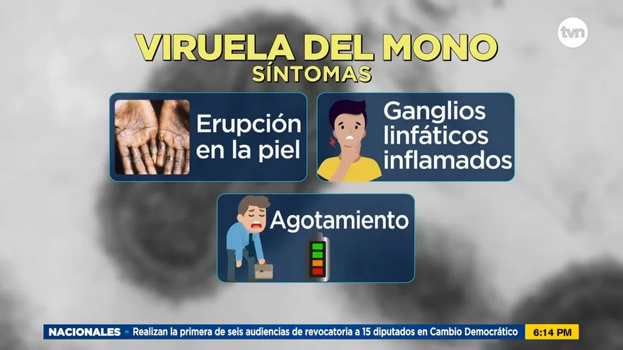 Síntomas de la viruela del mono