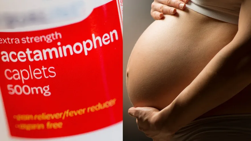 La declaraciones del presidente Trump vinculando el acetaminofen, conocido en Estados Unidos como Tylenol con el autismo han sido calificadas de irresponsables y peligrosas por gran parte de la comunidad científica