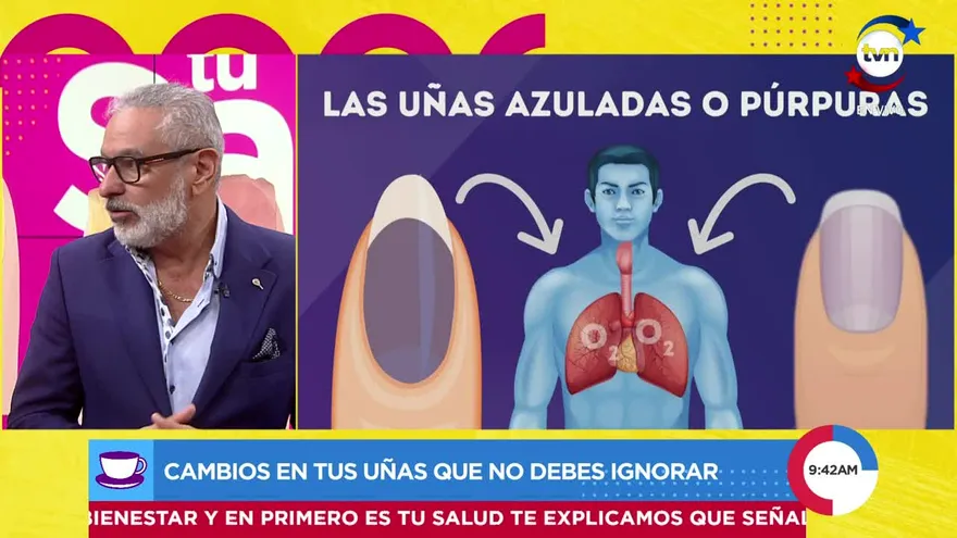 ¿Sabías que tus uñas pueden revelar problemas de salud?