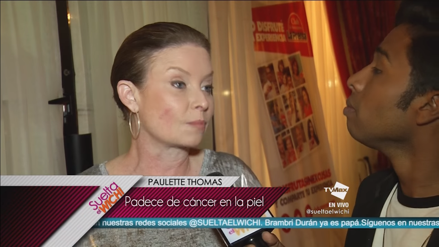 Paulette Thomas nos habla sobre el cáncer de piel