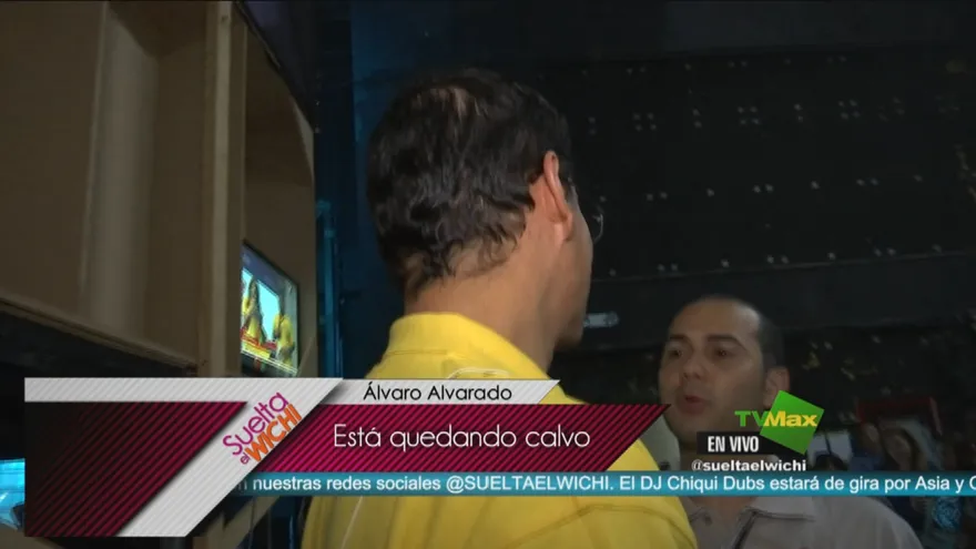 ¿Álvaro Alvarado se está quedando calvo?