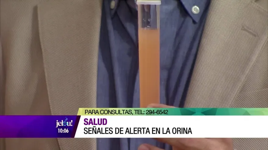 Señales de alerta en la orina