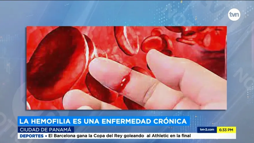 Día Mundial de la Hemofilia