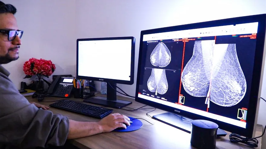 CSS estrena dispositivo para marcación precisa de lesiones en cáncer de mama