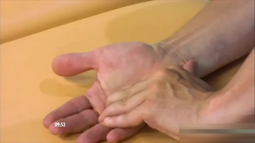 ¿Dolor en la manos? ¿Se te caen las cosas? Puede ser Síndrome de Túnel Carpiano