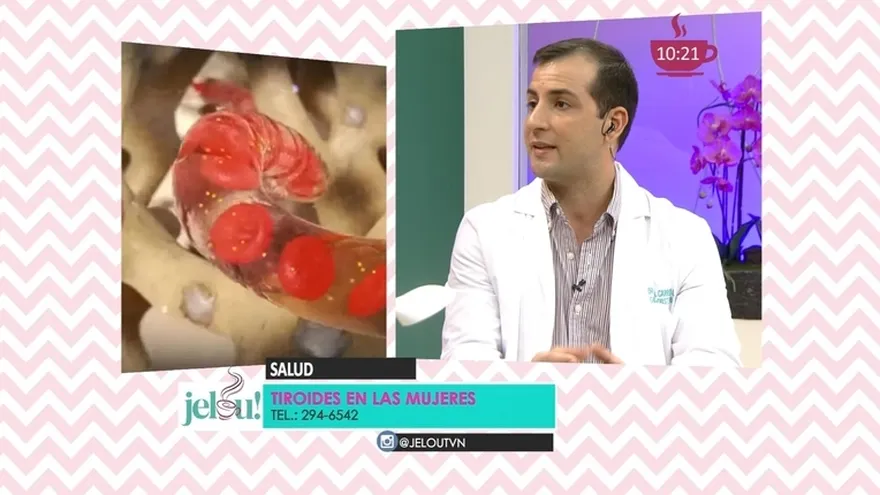 El problema de tiroides puede afectar la fertilidad en la mujer