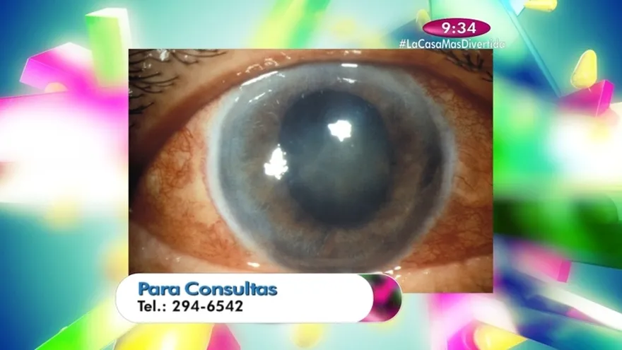 Segmento Salud al Día - El Glaucoma,sus causas y tratamientos