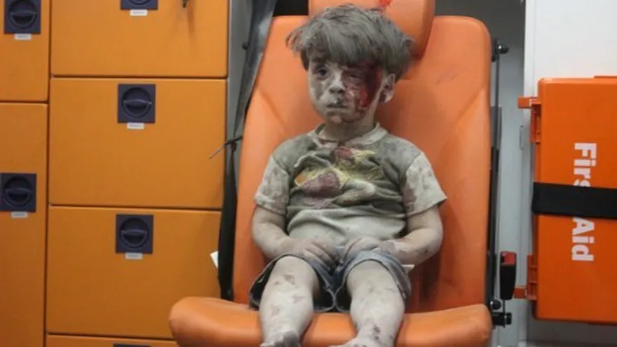 El pequeño Omran se ha convertido en un símbolo de la guerra en Siria.