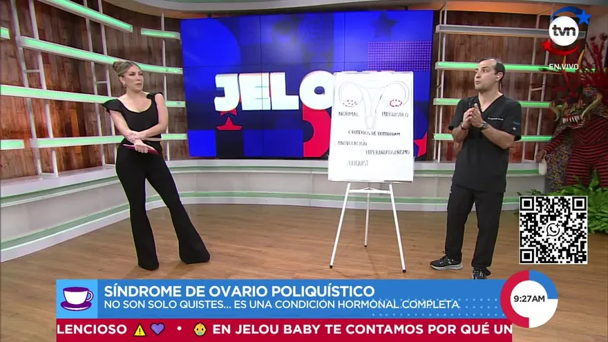 Síndrome de Ovario Poliquístico