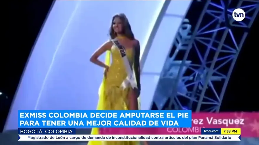 Exmiss Colombia decide amputarse el pie para tener una mejor calidad de vida
