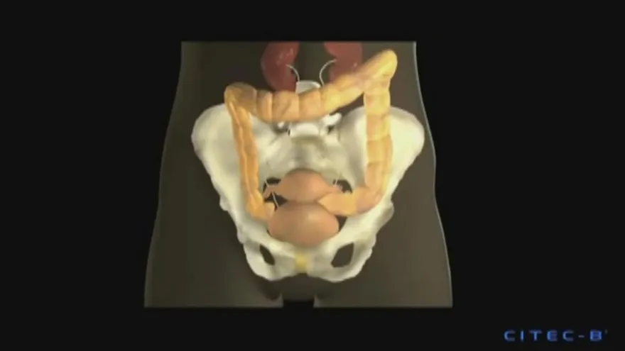 Infecciones urinarias en las mujeres ¡Prevención y tratamiento!