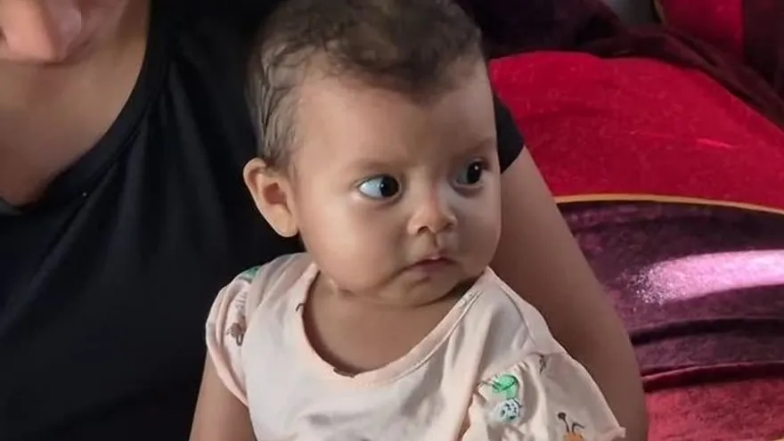 Bebé de ocho meses con cardiopatía congénita necesita una operación