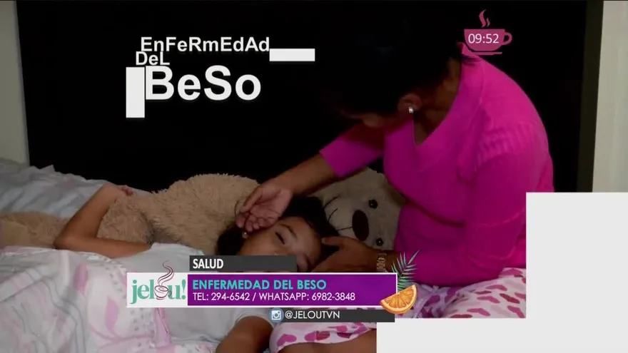 La mononucleosis, mejor conocida como la enfermedad del beso ¿Cómo se contagia y cómo prevenirla?