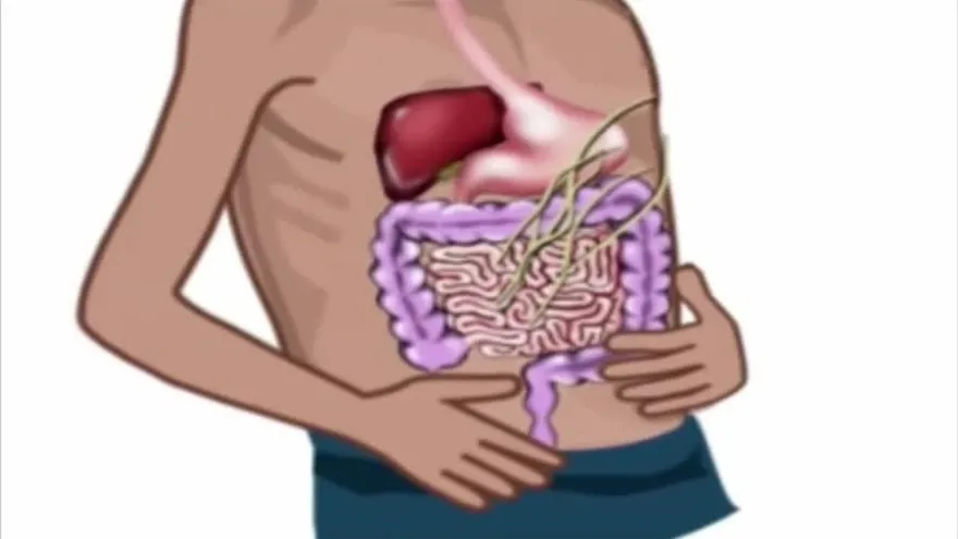 Cuidado con la amebiasis