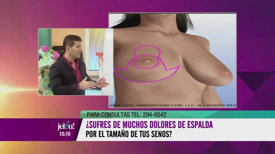 ¿Tienes senos grandes y te producen dolores de espalda?