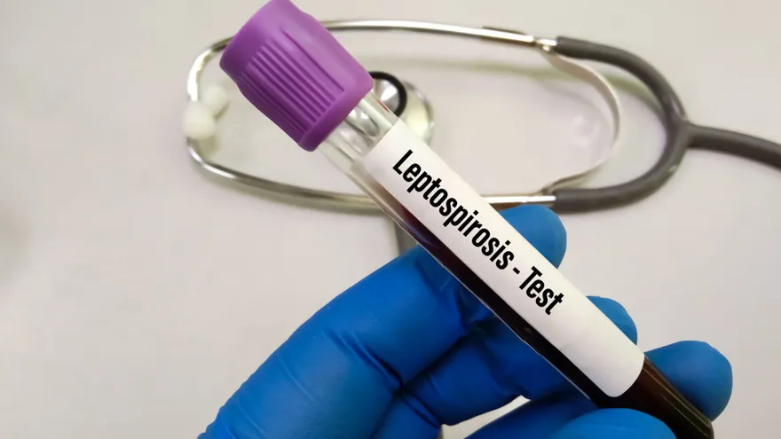 La leptospirosis se manifiesta principalmente con fiebre alta, diarrea y vómitos, síntomas de tipo gastrointestinal.