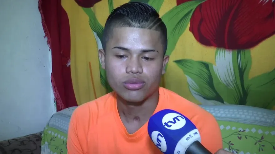 Accidente le cambia la vida