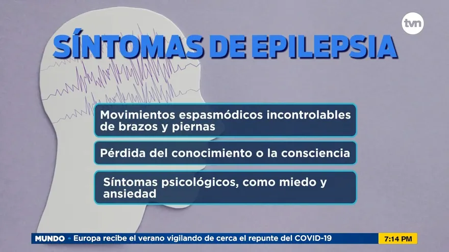 Síntomas de epilepsia