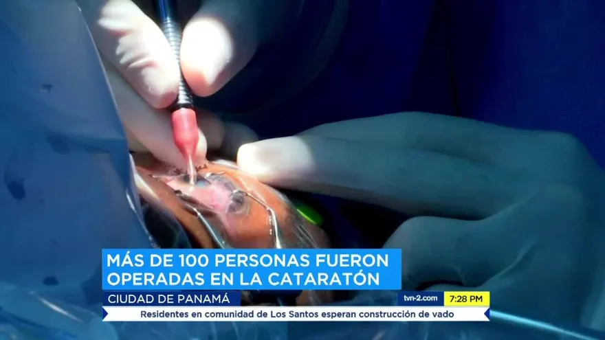 Se realiza Cataratón Kiwanis