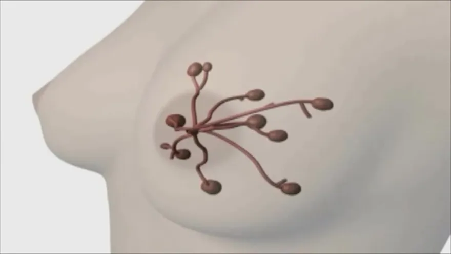 Los Senos y sus deformaciones ¡No eres la única! Hay hasta 8 tipos de mamas