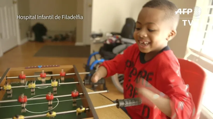 Primer trasplante doble de manos a niño en EEUU