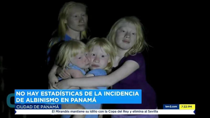 Buscan establecer el 13 de junio como ‘Día Nacional de Sensibilización sobre el Albinismo en Panamá’