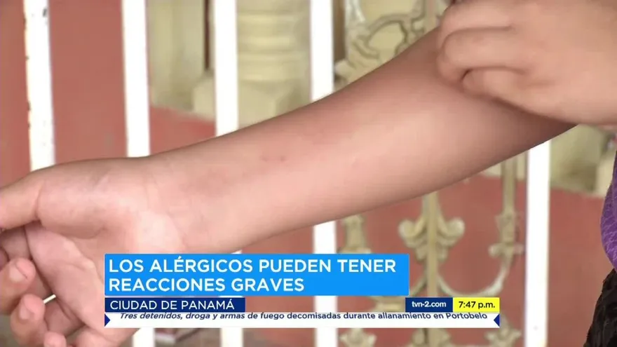 Continúan reportes de estudiantes afectados por erupciones en la piel