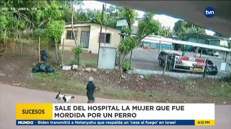 Mujer que fue mordida por un perro sale del hospital