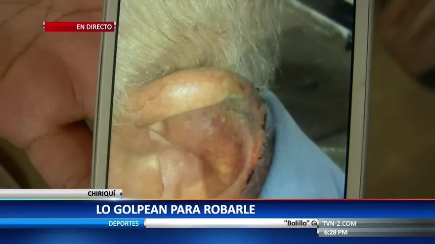 Adulto mayor es golpeado en su casa por delincuentes