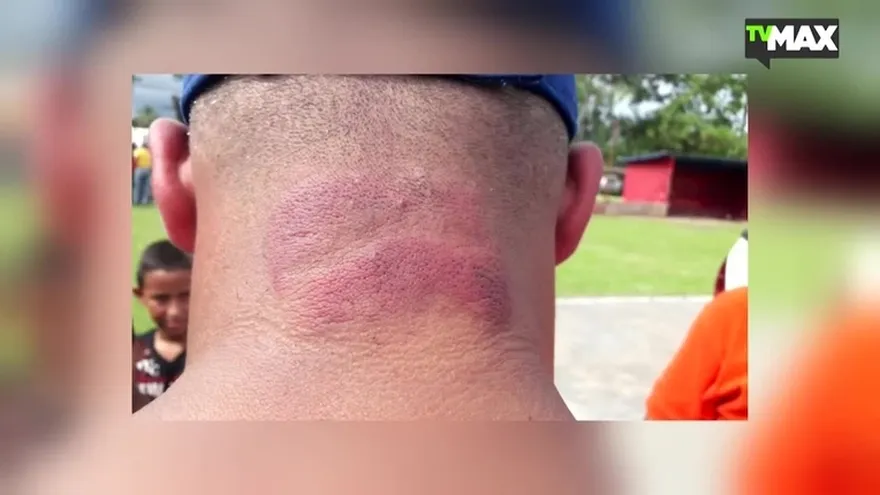 Incidente en liga provincial dejó dos peloteros heridos