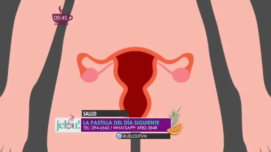 La pastilla del día siguiente. ¿Es 100% segura y confiable?