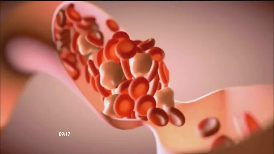 Entérate de los riesgos de tener la hemoglobina baja