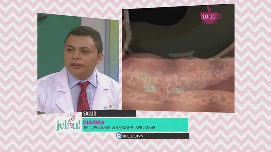 ¿Sabes por qué tienes diarrea?