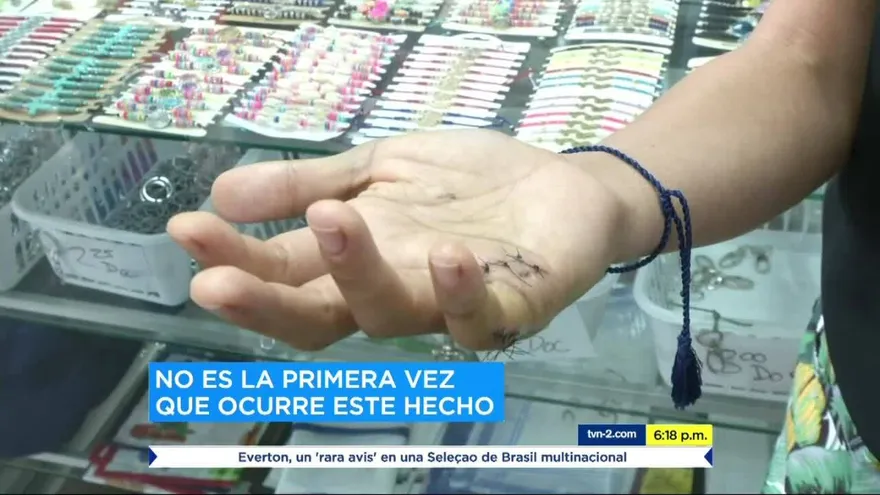 Mujer y su mascota son atacadas por un perro