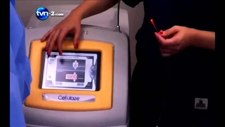 TRATAMIENTO CELULITIS