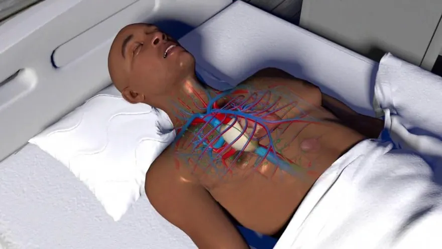 Videografía: Conoce todo sobre el Dengue