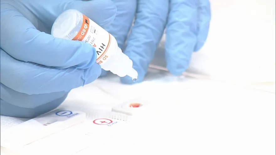 Ejemplo de prueba del VIH.