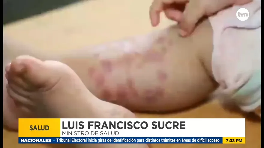 Se registran aumento de los casos de leishmaniasis
