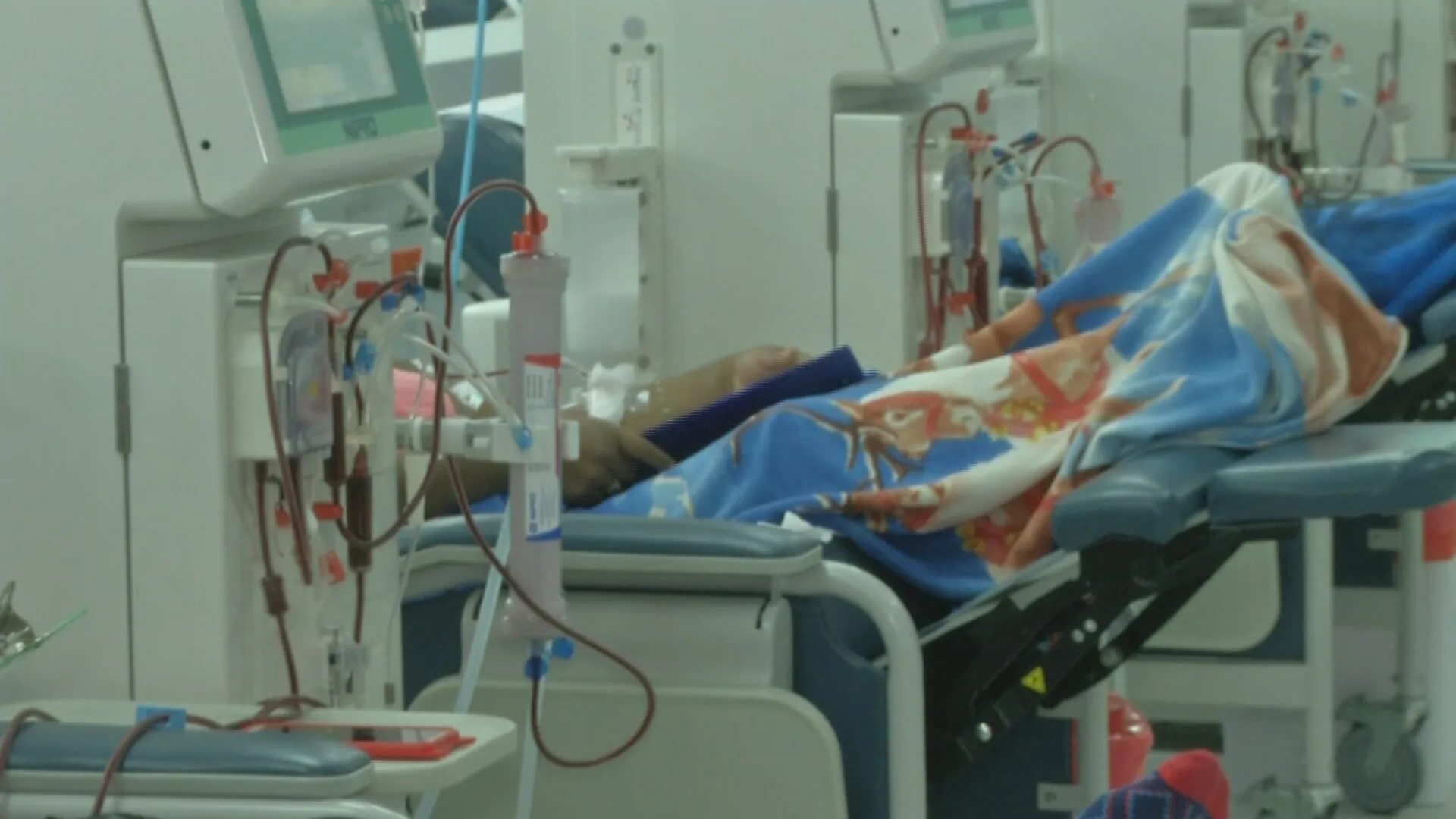 Tratamiento de diálisis