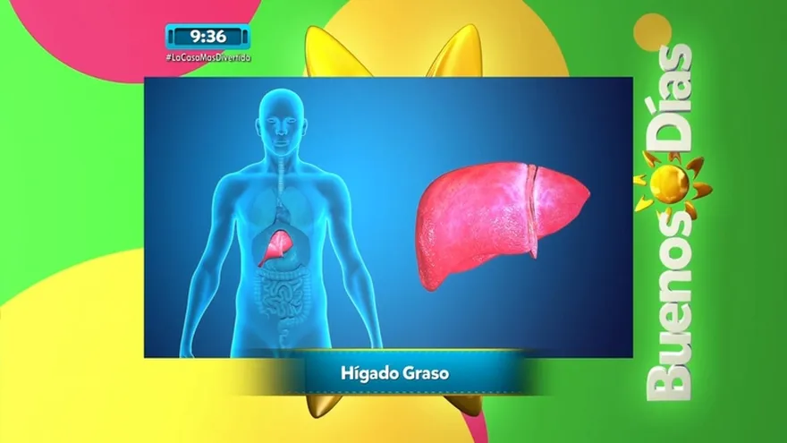 Hígado Graso