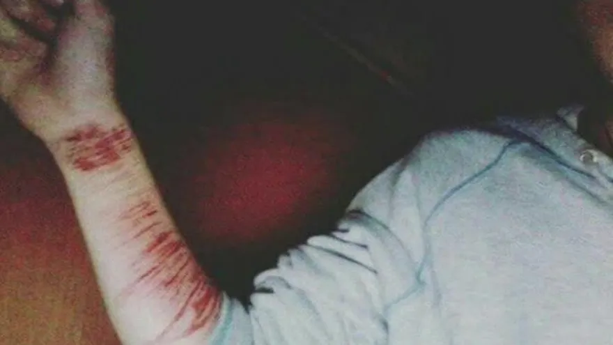 Jóvenes se cortan para llamar la atención