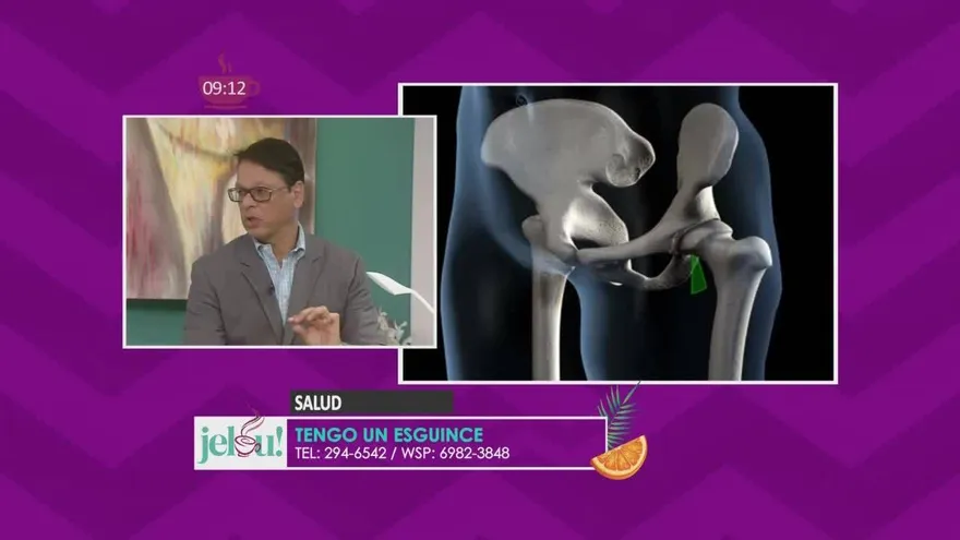 ¿Sabes cómo identificar si tu lesión es un esguince?