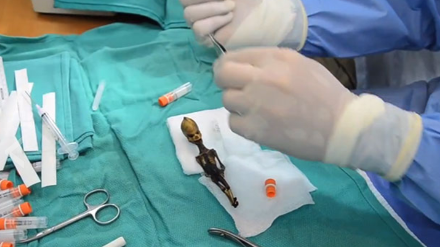 'Esqueleto de Atacama' no es un alienígena, así confirmaron pruebas de ADN.